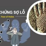 Cách khắc phục lỗ lã ban đầu trong thi công bê tông: Giải pháp triệt để từ chuyên gia cách khắc phục lỗ lã ban đầu