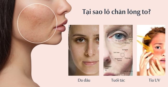 cách khắc phục lỗ lã ban đầu - Hình 2