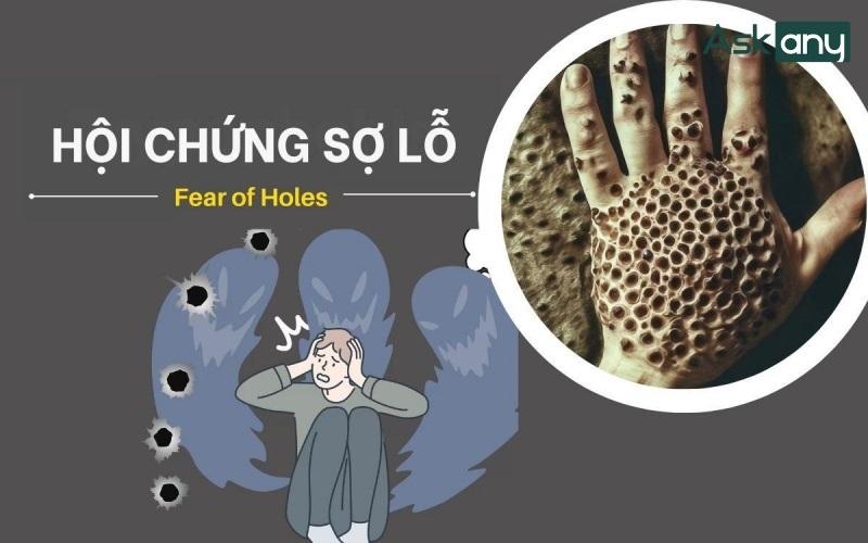 cách khắc phục lỗ lã ban đầu