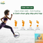 Toe Kick Là Gì? Tất Tần Tật Về Chân Tủ Bếp Mà Ai Cũng Cần Biết